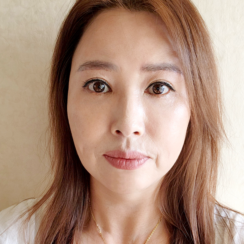 미니하안검흉터 고민은 이제 그만! 관련 이미지 1