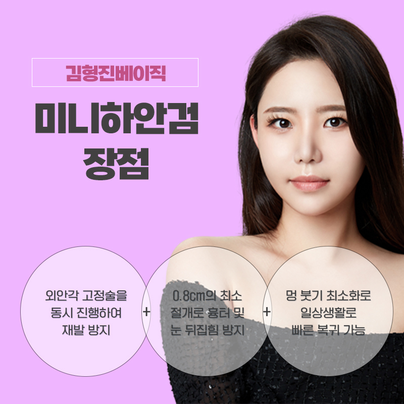 중년눈성형 고려 중이라면 김형진베이직에서! 관련 이미지 3