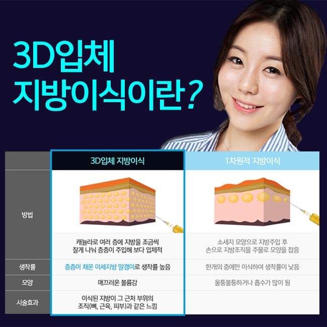 압구정지방이식 역시 다르네~ 관련 이미지 2