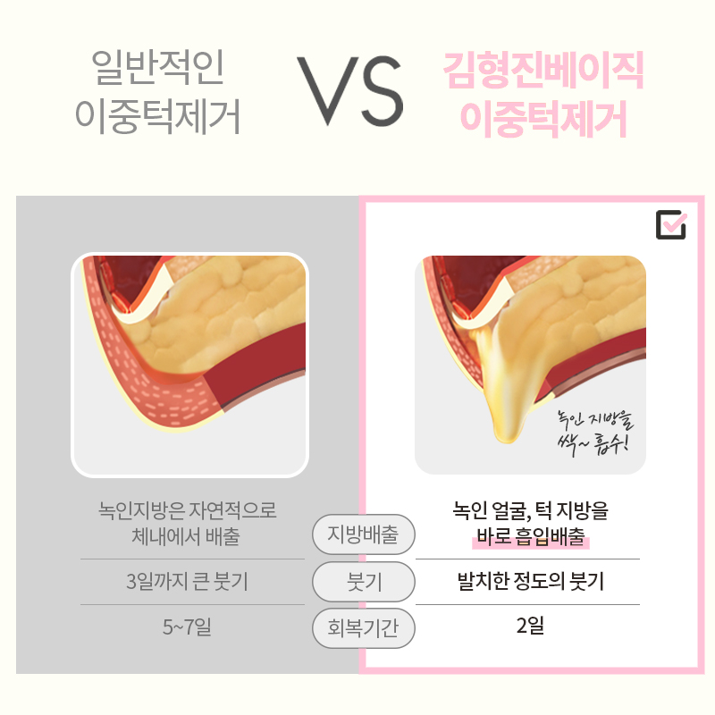 이중턱없애는방법에는 이만한 게 없어요 관련 이미지 5
