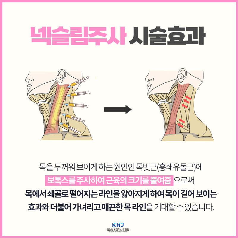한껏 가벼워진 목선, 넥슬림주사효과로 라인 완성하기 관련 이미지 4