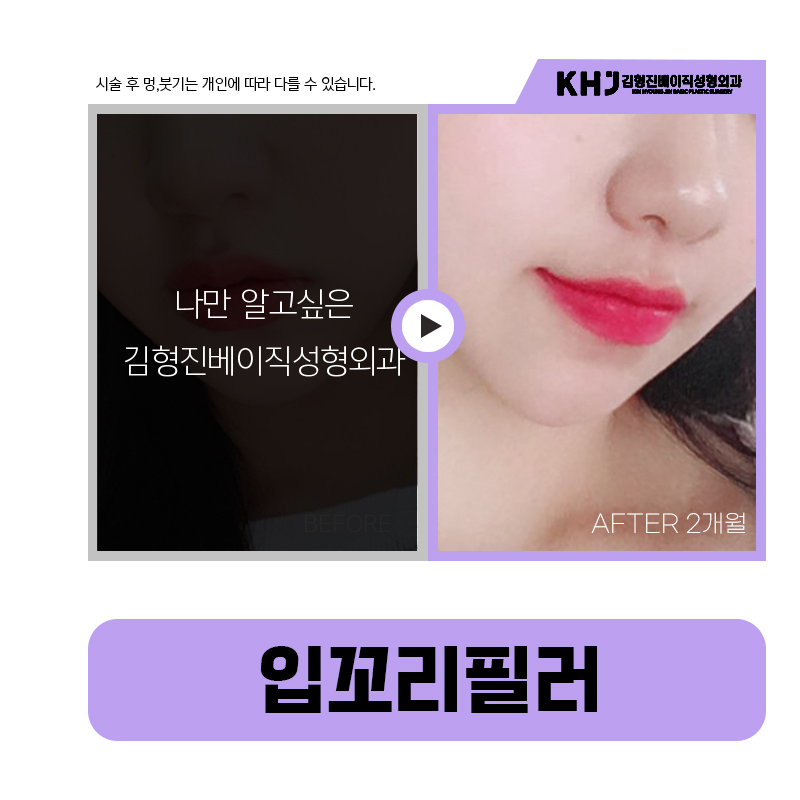 쉽고 간단하게 처진입꼬리 올리는법 관련 이미지 6