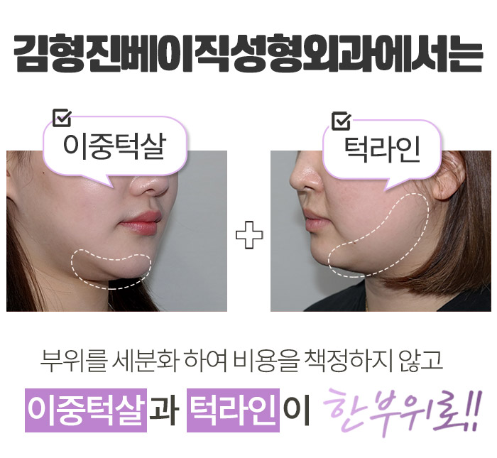 턱라인지방흡입 부담 없는 가격이죠 관련 이미지 2