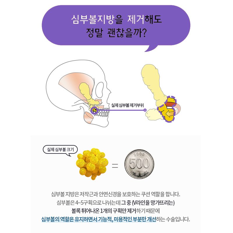 윈터 얼굴형 만들어 준 불독살제거방법 관련 이미지 4