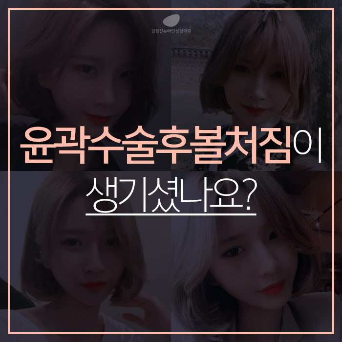 윤곽후볼처짐 해결책은 김형진뉴라인성형외과 소프트V라인 관련 이미지 2