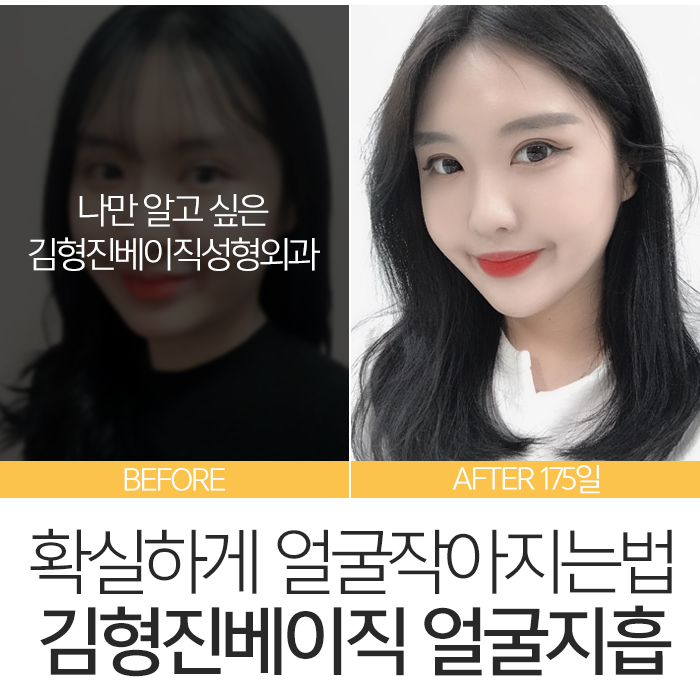 얼굴작아지는법 김형진베이직에서는? 관련 이미지 8