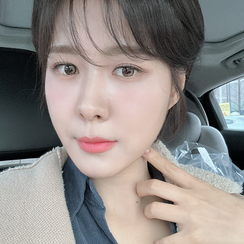 눈밑지방재배치붓기 적을 수밖에 없는 이유 관련 이미지 2