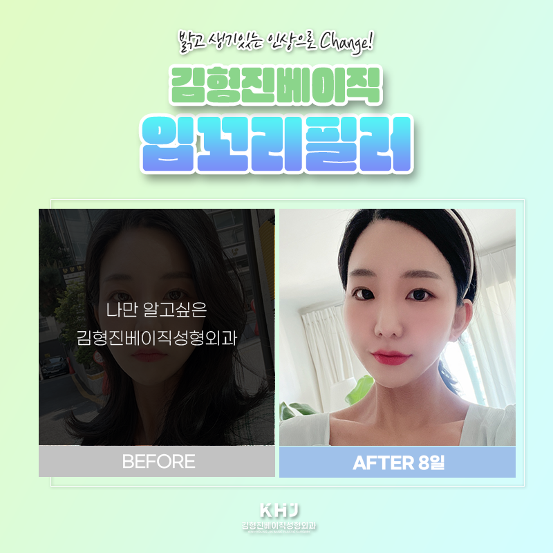 입꼬리올리는법 궁금하셨죠? 관련 이미지 6