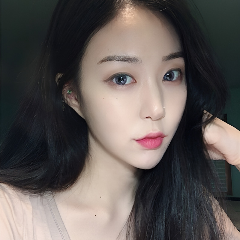 심부볼제거수술 볼패임 없이 할 수 있는 곳? 관련 이미지 1