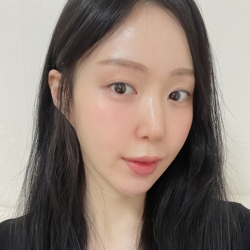 얼굴이 작아 보이는 비결, 심부볼제거술로 V라인 완성 관련 이미지 2