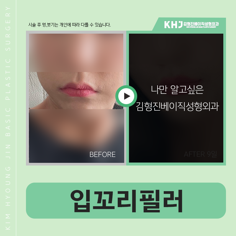 처진입꼬리 개선하고 싶을 땐? 관련 이미지 4