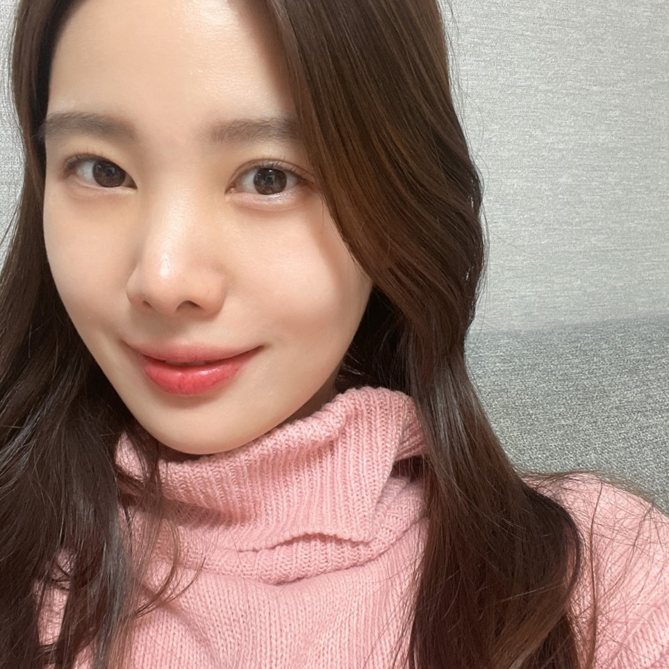 양악없이 빵떡 탈출한 얼굴지흡전후 관련 이미지 3
