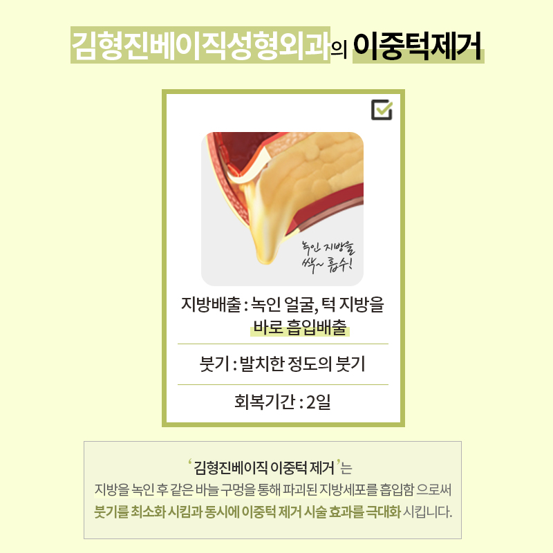 이중턱지방흡입붓기 걱정돼요? 관련 이미지 4