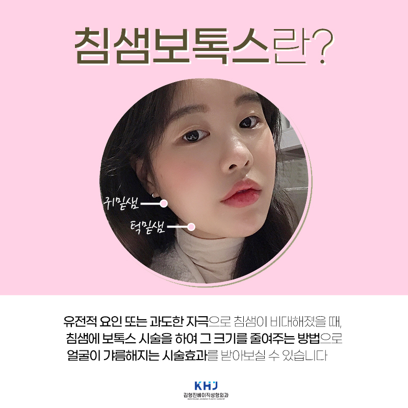 침샘보톡스잘하는곳 입소문 나는 곳은 다 이유가 있습니다 관련 이미지 4