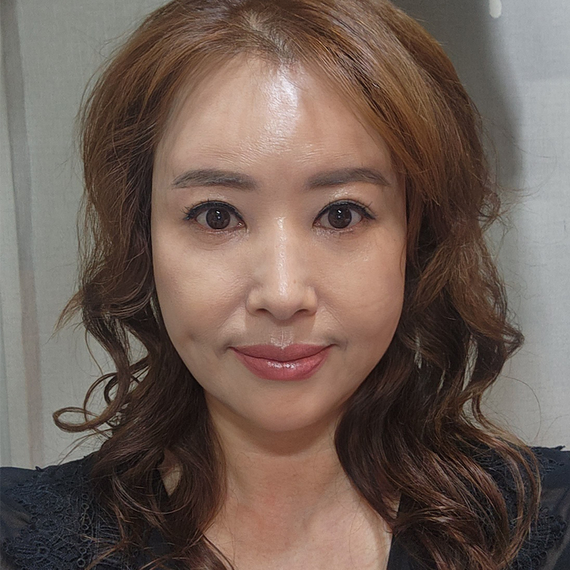 미니하안검절개 부담 갖지 않으셔도 되는 이유 관련 이미지 1