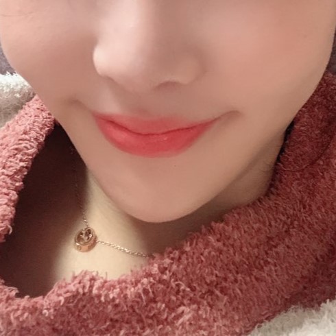 압구정입꼬리필러 잘하는 곳 찾고 있다면 관련 이미지 3