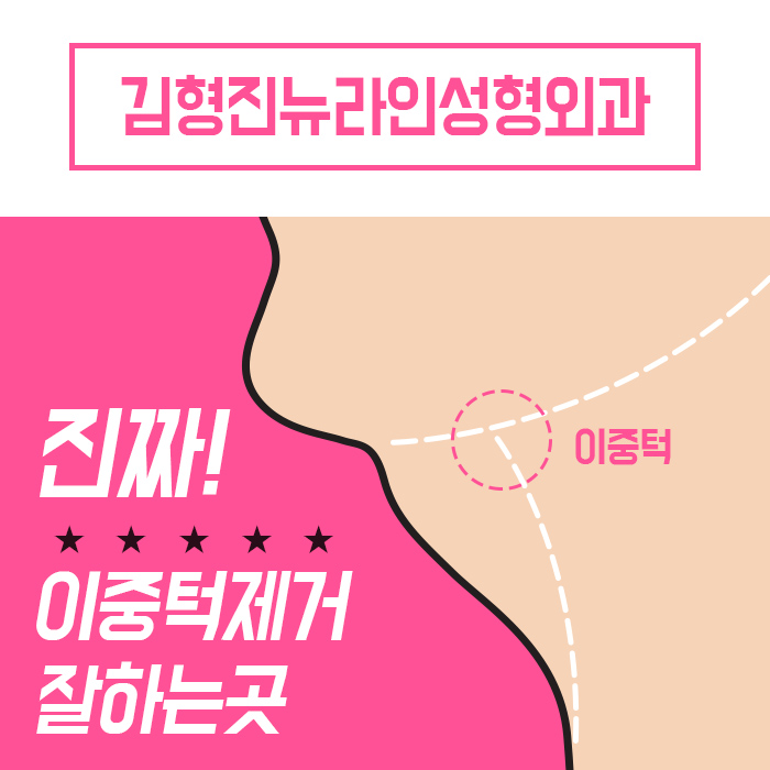 턱라인지방흡입 김형진원장이 체고야! 관련 이미지 2