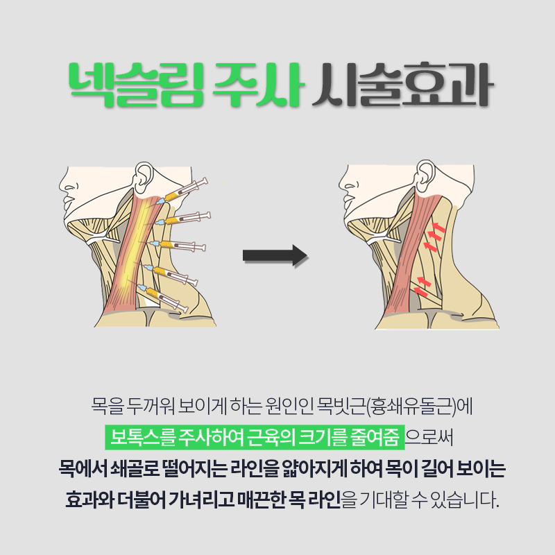 모르면 손해인 웨딩시술, 이것부터 하세요! 관련 이미지 3