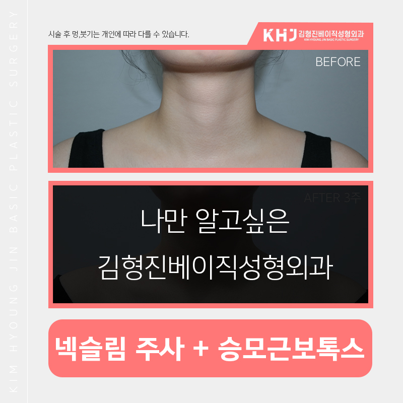 예비신부관리 시작해보자구요! 관련 이미지 6