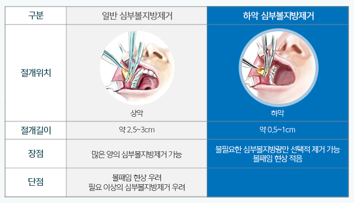 남자심부볼제거 해도 될까? 관련 이미지 5