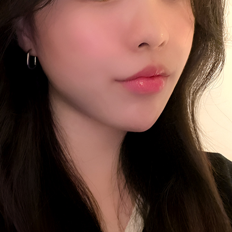 You can create more vibrant lips with just a mouth-corner filler procedure! image 1