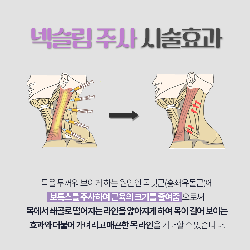 넥슬림주사시술, 아무 데서나 받으면 안 되는 이유 관련 이미지 4