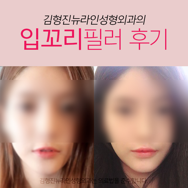 입꼬리필러후기 이정도는 되야지 관련 이미지 1