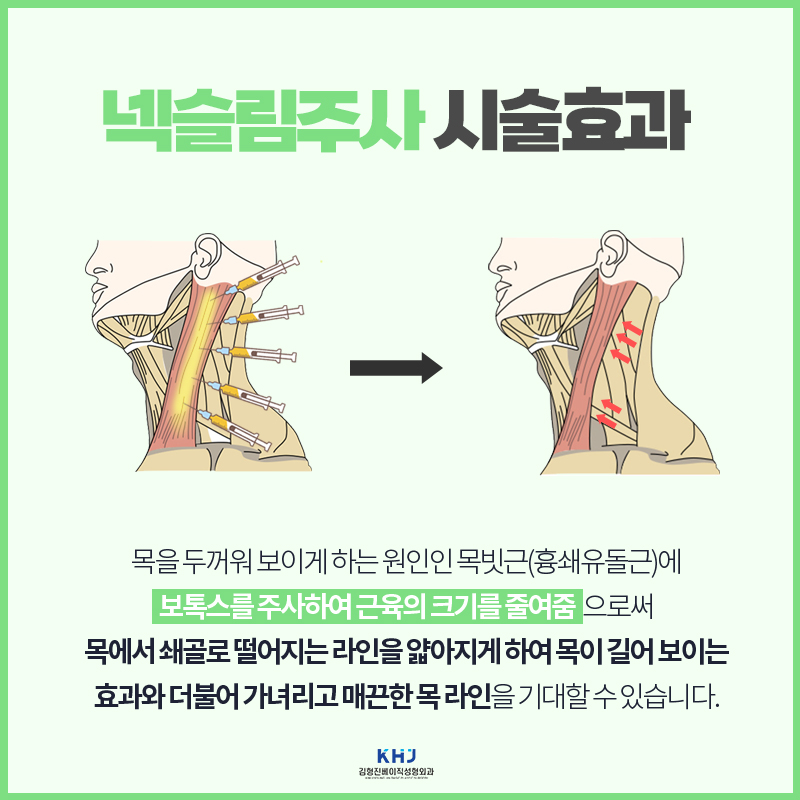 넥슬림주사시술 원조는 김형진베이직이죠 관련 이미지 4