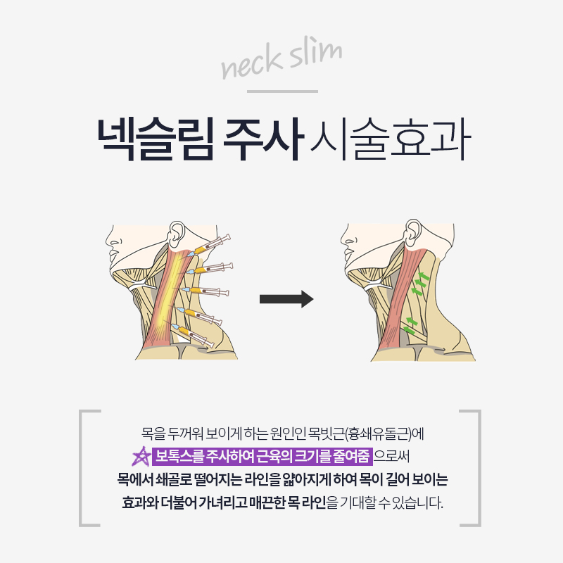 넥슬림주사로 이쁜 목라인 만들기 관련 이미지 5
