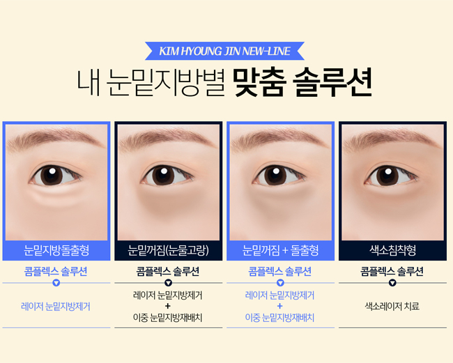 효도성형은 눈밑지방재배치로 초이스~ 관련 이미지 3