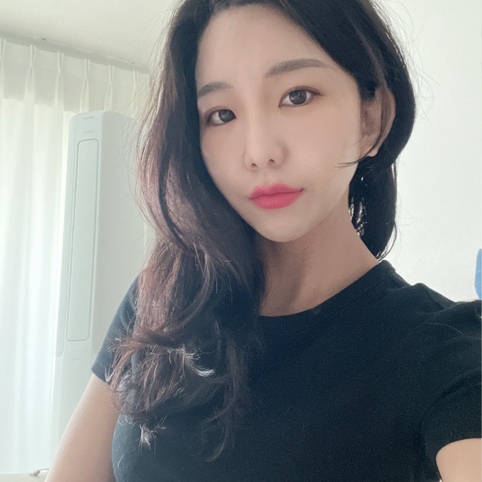 심부볼지방제거수술로 처진 불독살 개선 끝 관련 이미지 1
