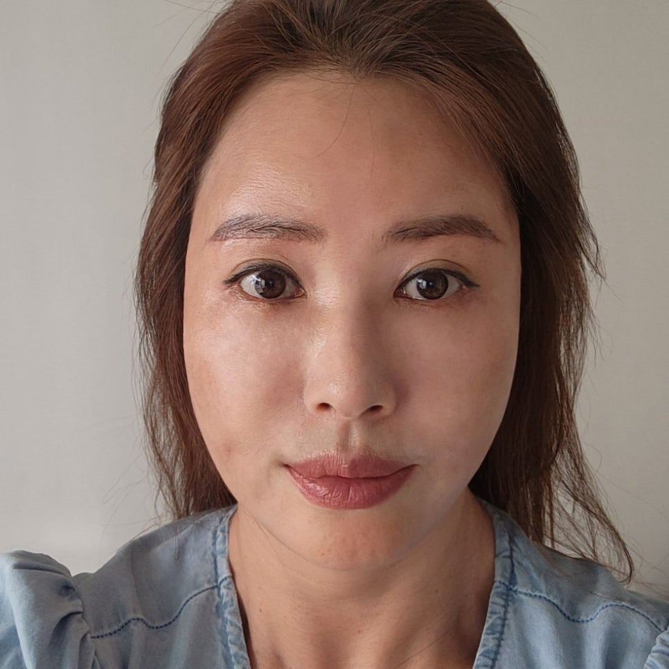 혹시 미니하안검비용 때문에 망설이고 계셨다면 관련 이미지 1