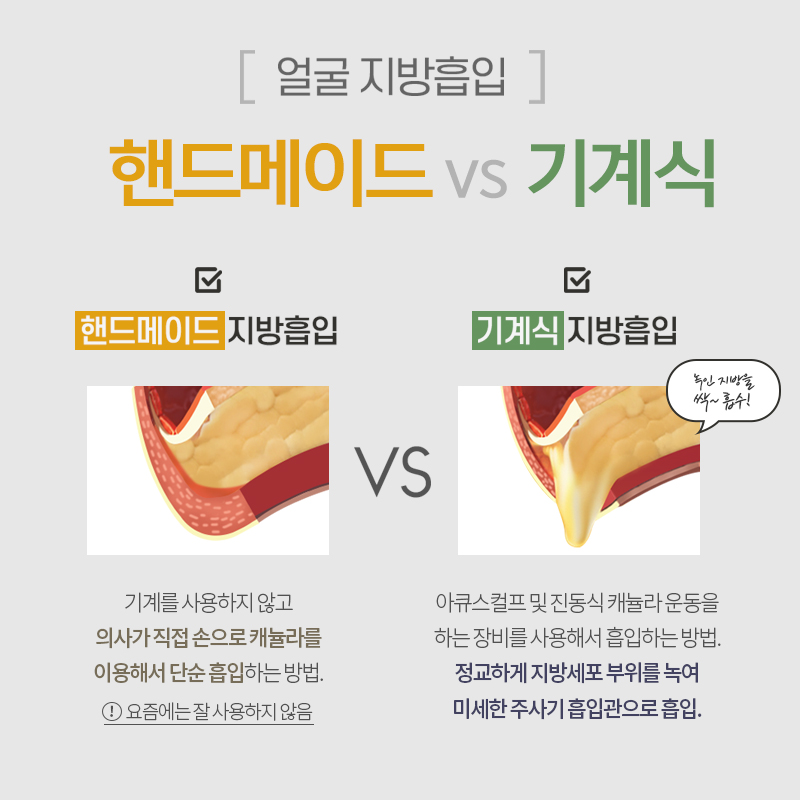 얼굴지방흡입방법 어떻게 진행되냐구요? 관련 이미지 3