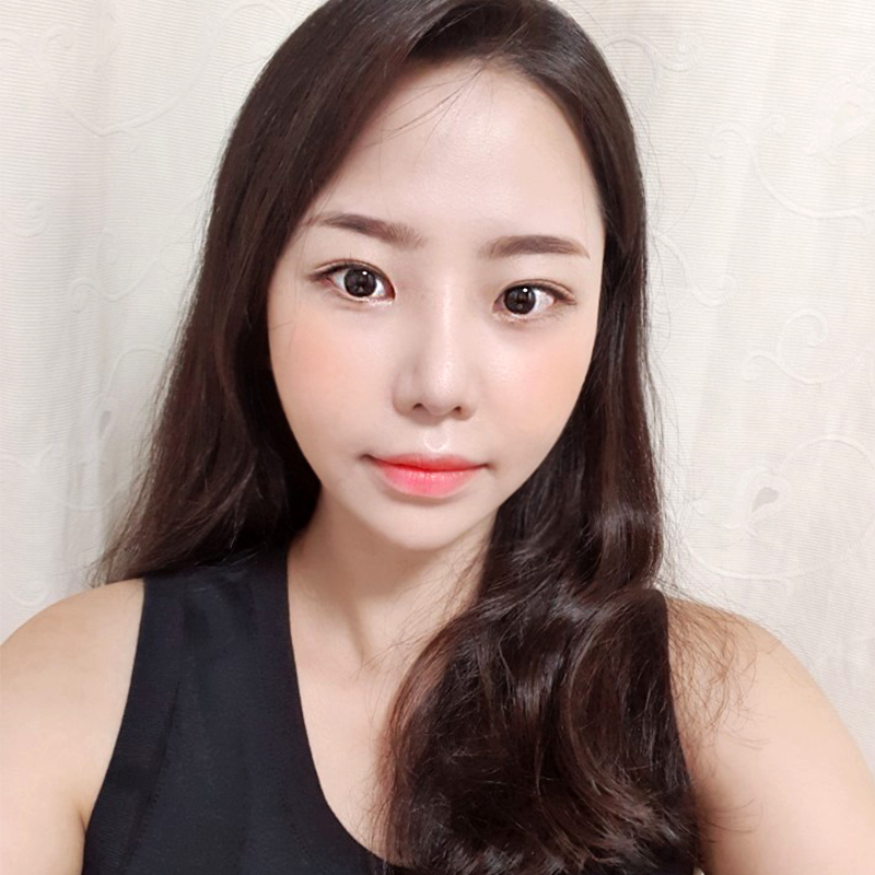 심부볼제거부작용 걱정은 이제 노노! 관련 이미지 6