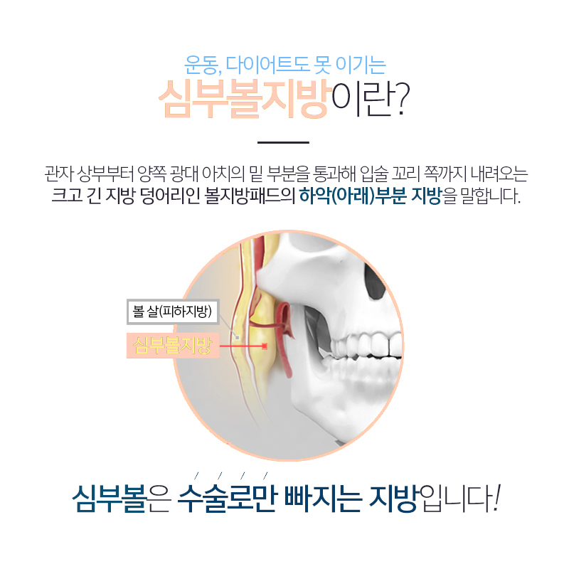 압구정심부볼지방제거 볼패임 걱정할 필요 없었어요 관련 이미지 3
