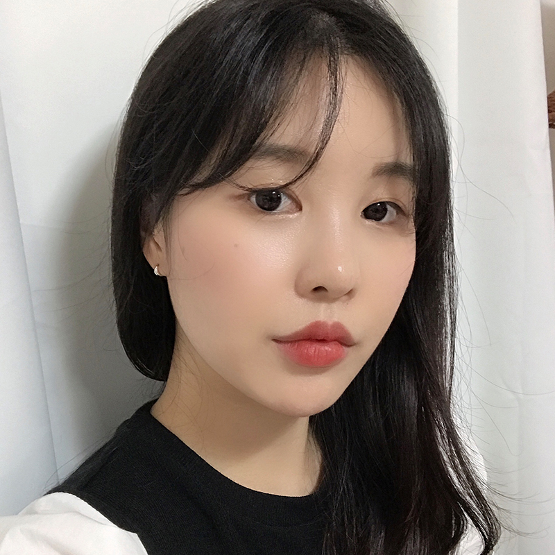 입꼬리필러 맞고 웃상얼굴 되어보기 관련 이미지 1