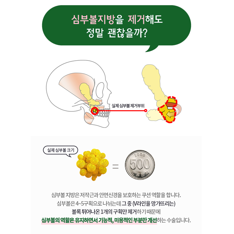 압구정심부볼지방제거로 얼굴형 망치는 원인 너무 쉽게 해결! 관련 이미지 4