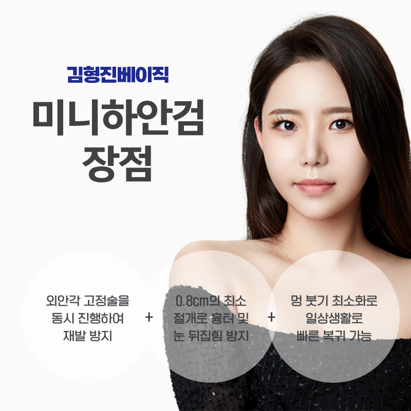 미니하안검절개 걱정 안해도 되는 이유 관련 이미지 5