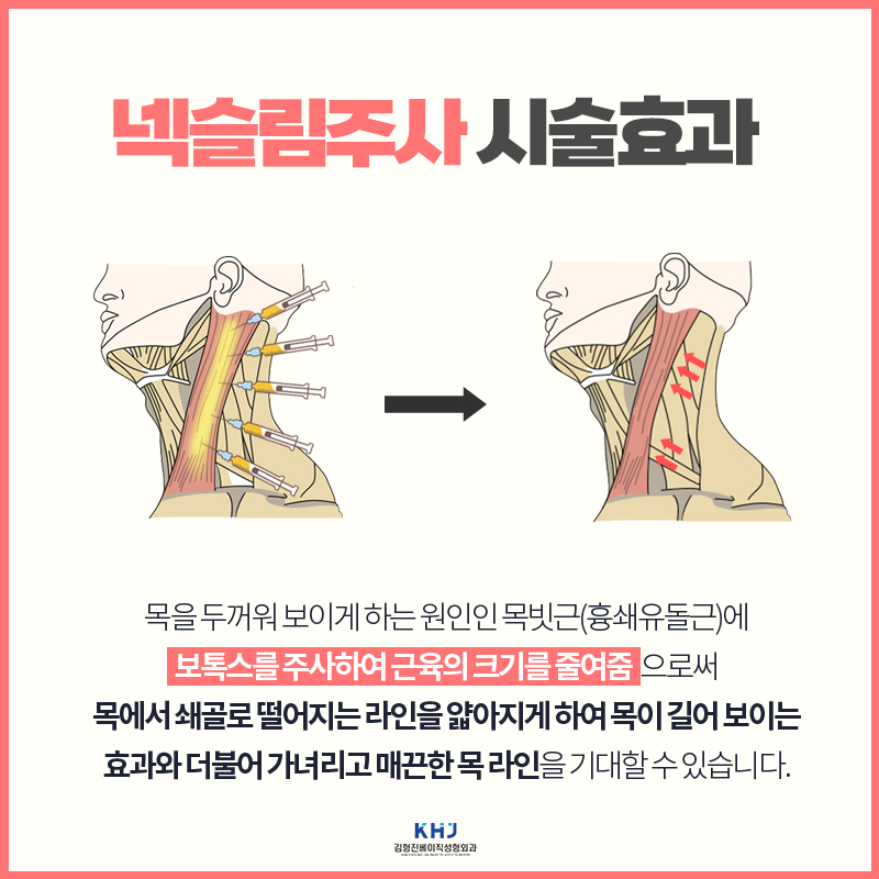 요즘 관리하는 여자들은 다 한다는 넥슬림주사후기 관련 이미지 4