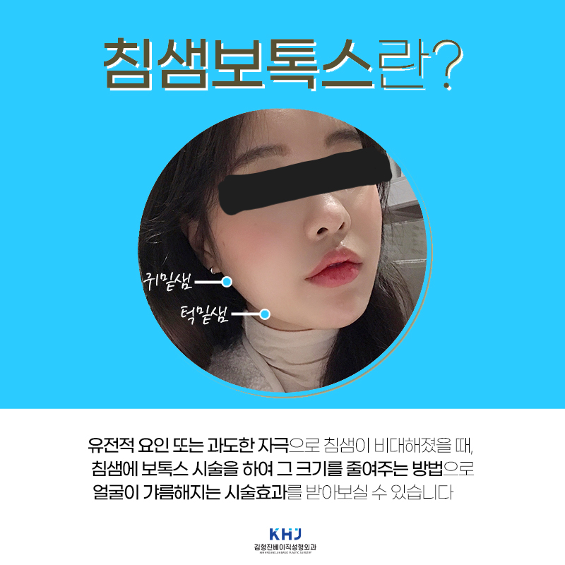 침샘보톡스주기 제대로 알려주는 유일했던 곳 관련 이미지 3