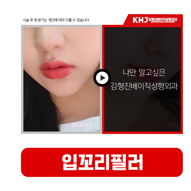 인상을 결정하는 핵심, 입꼬리올리는법 관련 이미지 5