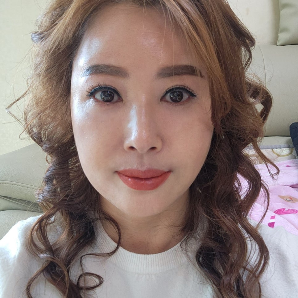 중년눈수술후기 진짜 어쩌면 좋죠? 관련 이미지 1