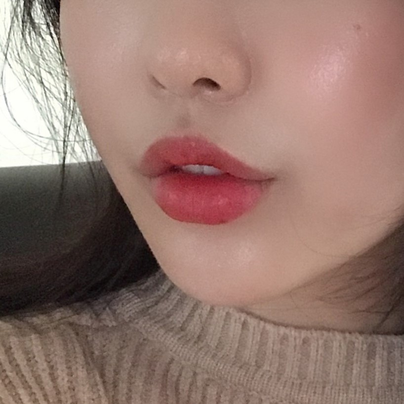 입꼬리비대칭? 입꼬리필러로 생기 있는 미소 완성! 관련 이미지 3