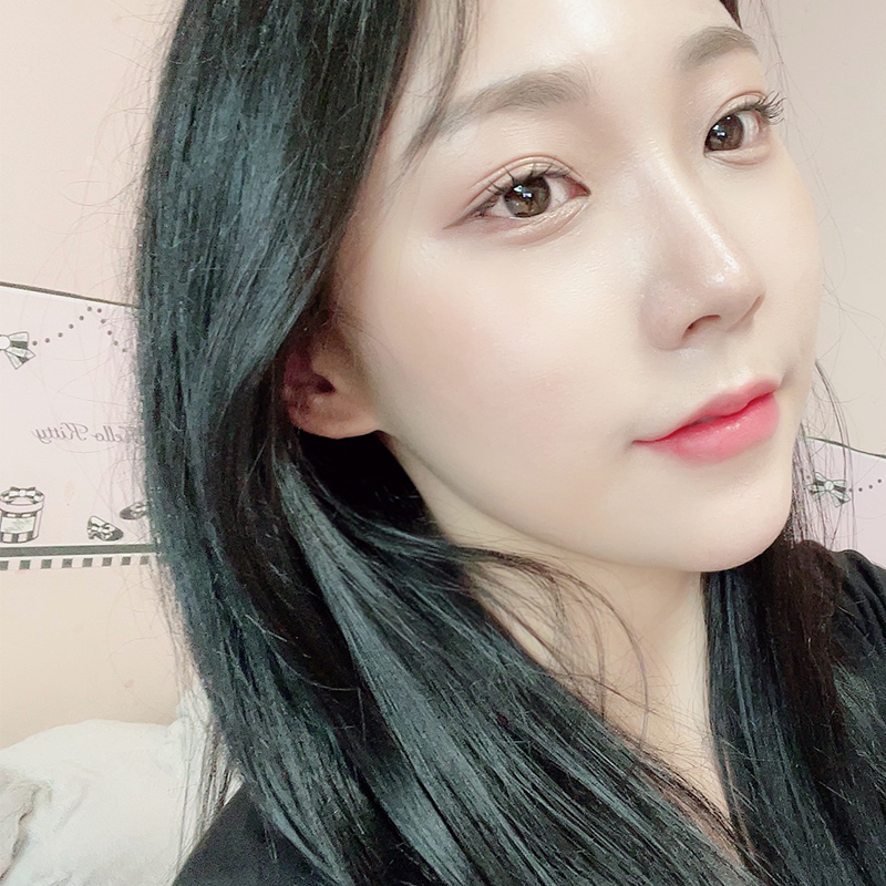 침샘보톡스효과 아직도 모르셨다면 관련 이미지 3