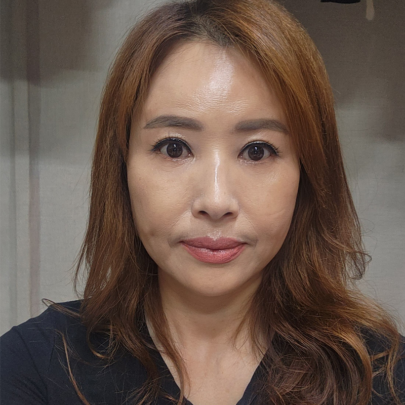 중년눈밑처짐 개선하고 싶으시다면? 관련 이미지 1