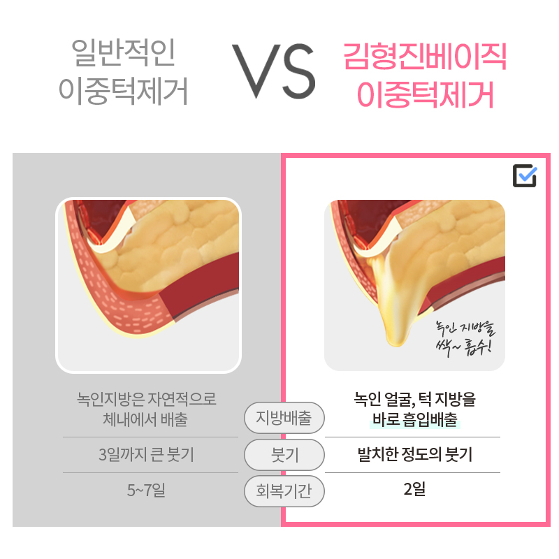 후덕한 얼굴살제거 가장 빨리 해결할 수 있는 방법! 관련 이미지 5