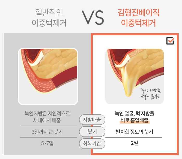투턱주사 언제까지 맞으려구요? 관련 이미지 5