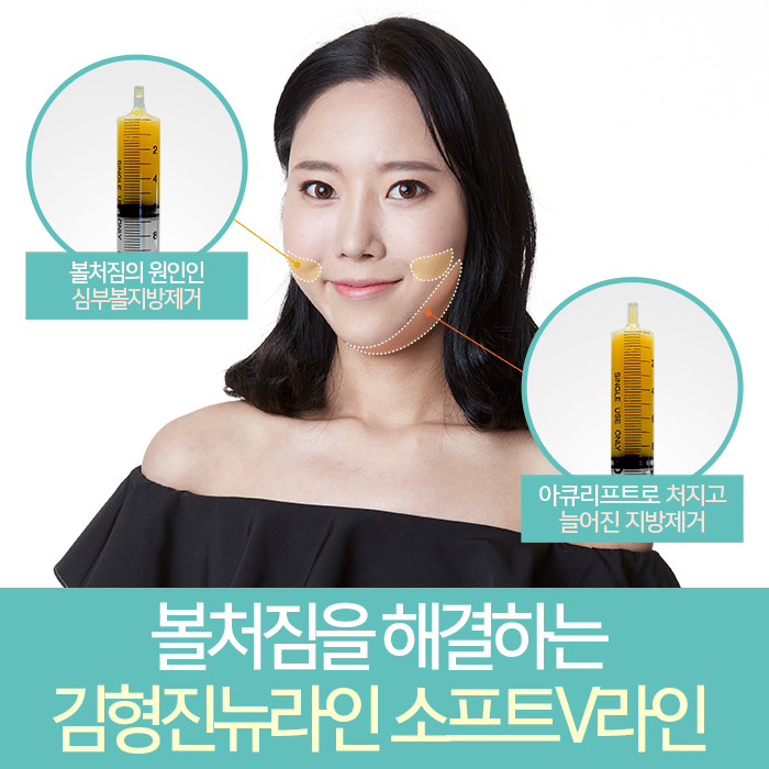 안면윤곽후리프팅 정답이라고 확신해요? 관련 이미지 4