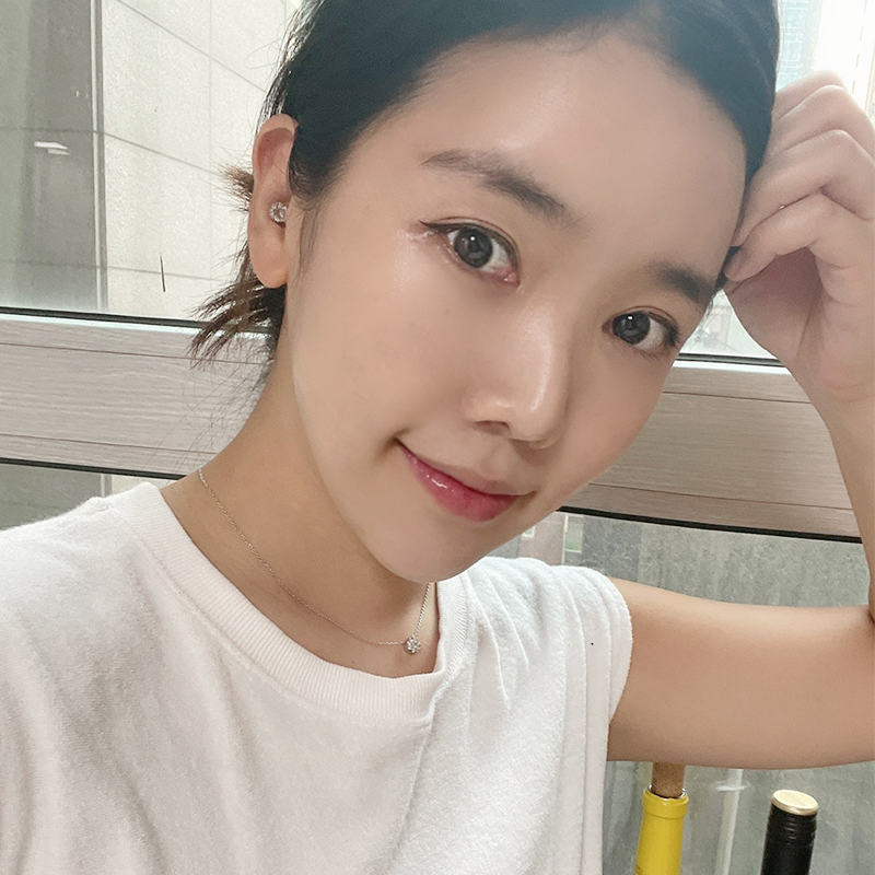 입꼬리필러시술 아직도 고민중이세요? 관련 이미지 2