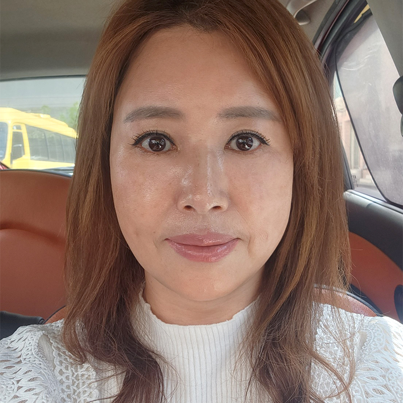 미니하안검절개 부담 갖지 마세요! 관련 이미지 1